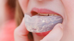 mouthguard