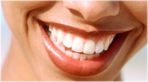Dental implants and improving your smile: A dental implant procedure is used to replace missing teeth. This image features a closeup of a woman's smile.