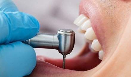 Restorative dentistry is imperative to maintaining healthy teeth.