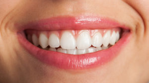 What are veneers, you ask? Well, it's a quick and painless dental procedure that can beautify your smile.