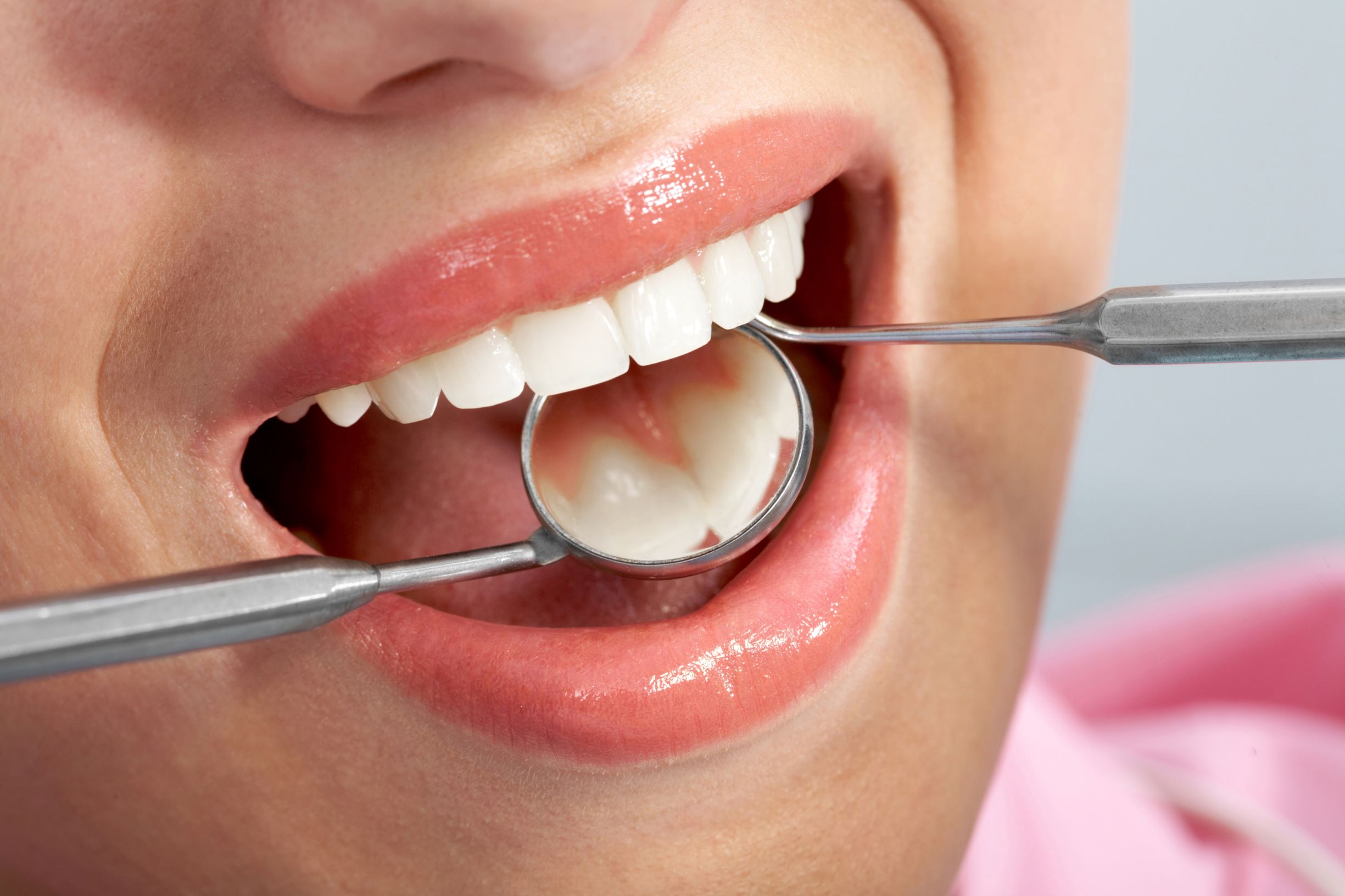A dental filling procedure includes several steps. The dentist can explain them to help you follow along.