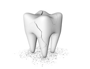 A tooth fracture isn’t always visible to the naked eye, especially because it could be beneath the gumline, as shown at the bottom of this rendering.